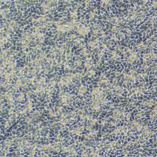 HGC-27（人胃癌细胞（未分化））