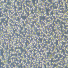 HL-60（人原髓细胞白血病细胞）