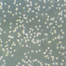 Jurkat, Clone E6-1（人T淋巴细胞白血病细胞）