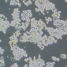 MDA-MB-453（人乳腺癌细胞）