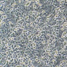 NCI-H1299（人非小细胞肺癌细胞）