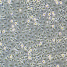 NCI-H1650（人非小细胞肺癌细胞）