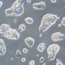 NCI-N87 [N87]（人胃癌细胞）