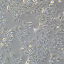 RBE（人肝胆管癌细胞）