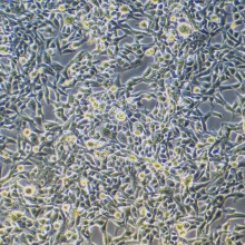 RD（人恶性胚胎横纹肌瘤细胞）