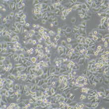 SK-BR-3 [SKBR3]（人乳腺腺癌细胞）