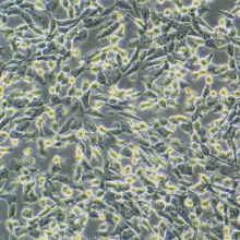 SK-Hep-1（人肝癌细胞）