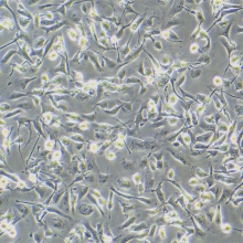 SK-OV-3（人卵巢癌细胞）