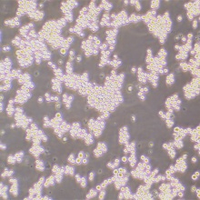 SP2/0（小鼠骨髓瘤细胞）