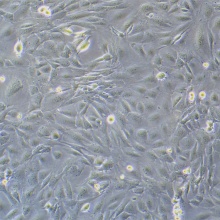 SVEC4-10（小鼠淋巴结内皮细胞）