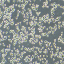 SW620（人结肠癌细胞）