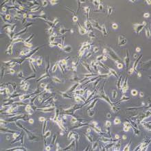 U251（人胶质瘤细胞）