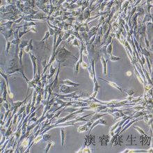 U-87 MG（人脑星形胶质母细胞瘤细胞）