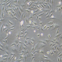 Vero（非洲绿猴肾细胞）