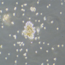 YAC-1（小鼠淋巴瘤细胞）