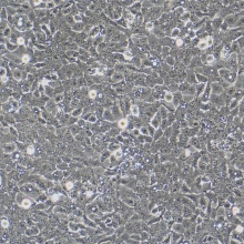 Ishikawa（人子宫内膜癌细胞）