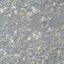 NCI-H23（人非小细胞肺癌细胞）