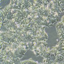 NCI-H358（人非小细胞肺癌细胞）