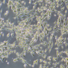 NCI-H446 [H446]（人小细胞肺癌细胞）