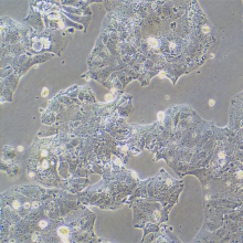 PLC/PRF/5（人肝癌亚力山大细胞）