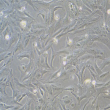 SW 1353（人软骨肉瘤细胞）