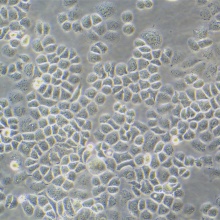 SW-13（人肾上腺皮质小细胞癌细胞）