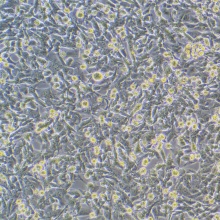 UM-UC-3（人膀胱移行细胞癌）