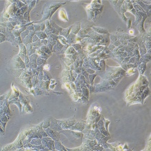 NCI-H2228 [H2228; H-2228]（人肺癌细胞）