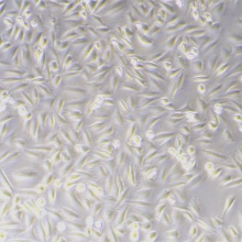 LN229（人大脑神经母瘤细胞）