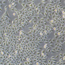 SMMC-7721（人肝癌细胞）