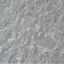 NCI-H441（人肺腺癌细胞）