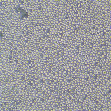 K562（人慢性髓系白血病细胞）