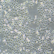 HEp-2（人喉表皮样癌细胞）
