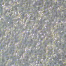 A-204（人横纹肌肉瘤细胞）