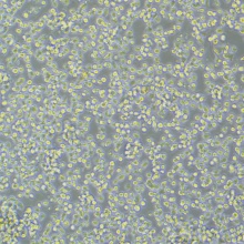 T2（人淋巴母细胞）