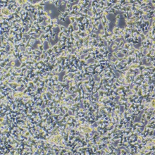 IMR-32（人神经母细胞瘤细胞）