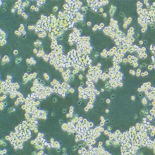 MKN-45（人胃癌细胞）