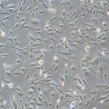 HMEC-1（人微血管内皮细胞株）
