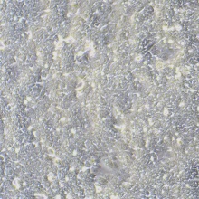 HPAC（人胰腺癌细胞）