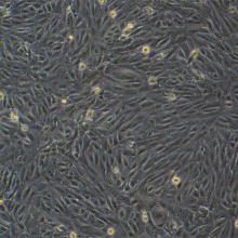 SV40-MES-13（小鼠肾小球系膜细胞）