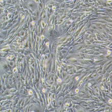 MEF（小鼠胚胎成纤维细胞）