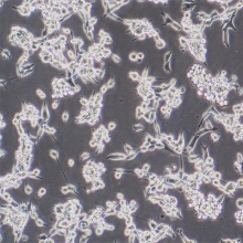 U14（小鼠宫颈癌细胞）