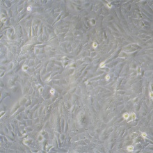 HOS（人骨肉瘤细胞）