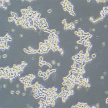 WERI-Rb-1（人视网膜母细胞瘤）