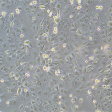 HuCCT1（人胆管癌细胞）