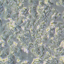 NCI-H1437（人非小细胞肺癌细胞）