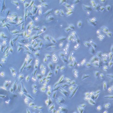 NCI-H1703（人肺腺鳞癌细胞）