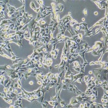 NCI-H1944（人非小细胞肺癌细胞）