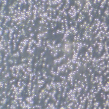 SU-DHL-6（人淋巴瘤细胞）