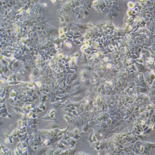 OV-90（人卵巢癌细胞）